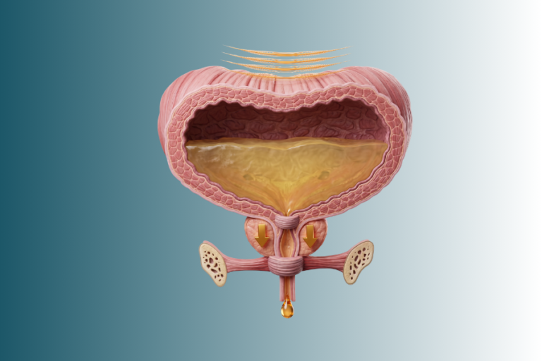 A Cirurgia Robótica Reduz o Risco de Incontinência Urinária?
